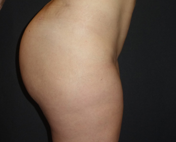 After Feature Image