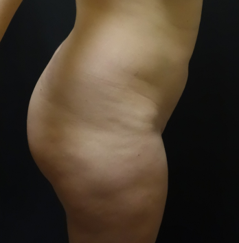 Before Feature Image